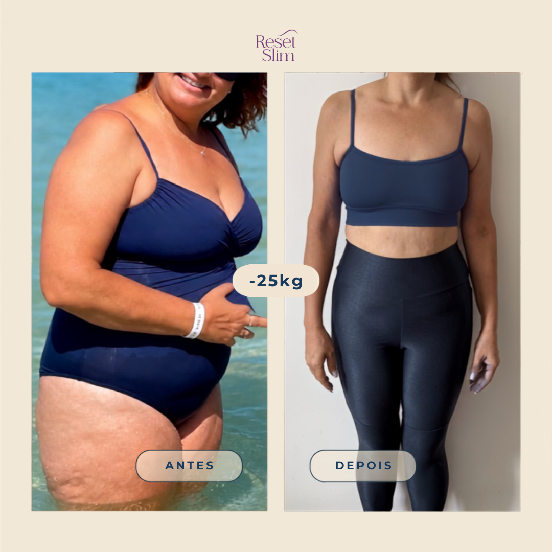 Comparação de antes e depois de participante do Reset Slim — foto 2