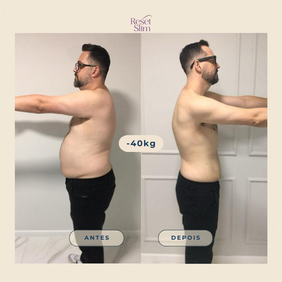 Comparação de antes e depois de participante do Reset Slim — foto 3