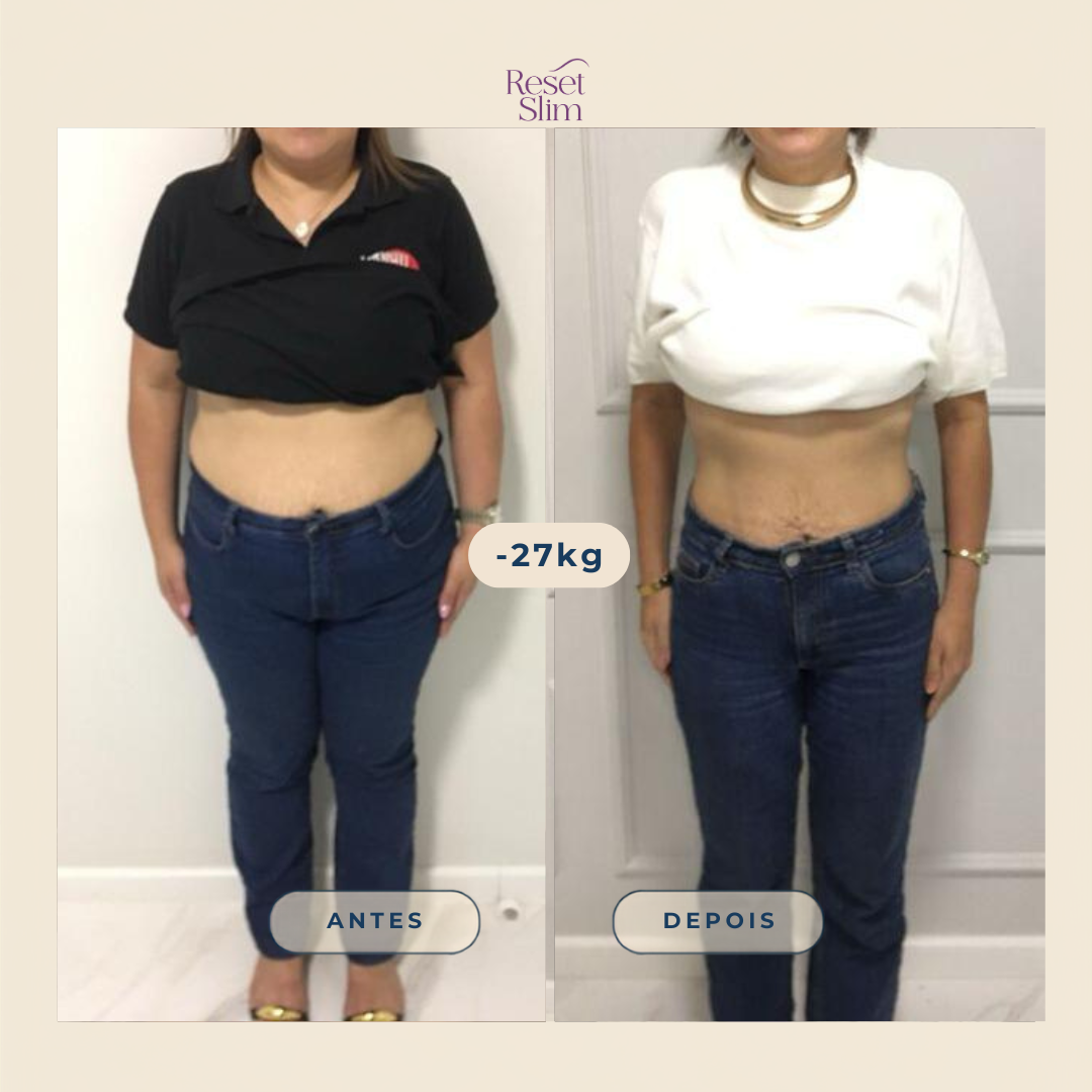 Comparação de antes e depois de participante do Reset Slim — foto 5